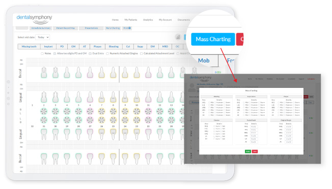 Masschart button showing masschart look